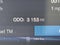 2026 Volvo XC40 Plus, B5 AWD Gas (mild hybrid), Dark